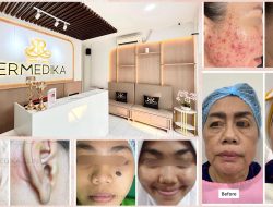 Emerdika Clinic Hadir Dengan Wajah Baru, Perkuat Fokus Pada Bedah Kulit, Acne, dan Anti-Aging Treatment